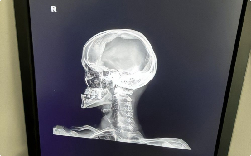 Встановлення рентгенівського діагностичного апарату Lanmage 7500 Athena у КНП “ТАЛЬНІВСЬКА БАГАТОПРОФІЛЬНА ЛІКАРНЯ”